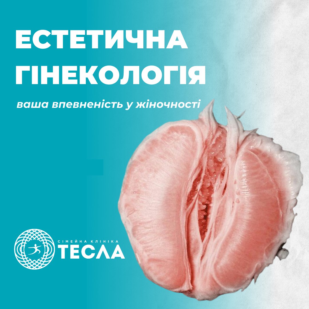 Эстетическая гинекология уже у ТЕСЛА Нежин! 😍